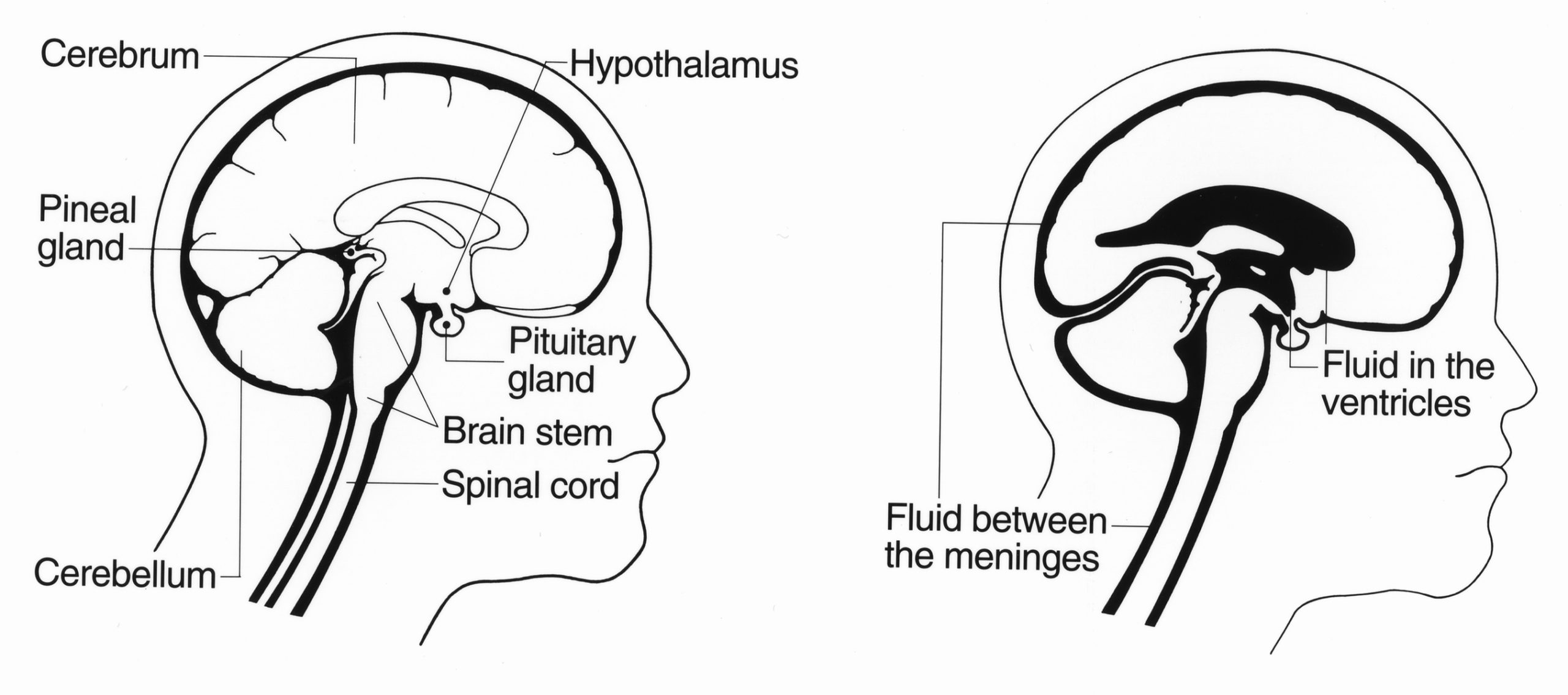 Caffeine vs Modafinil: How Do They Compare for Alertness? 2 Illustration of the human brain, representing Modafinil's effect on alertness and cognitive activity