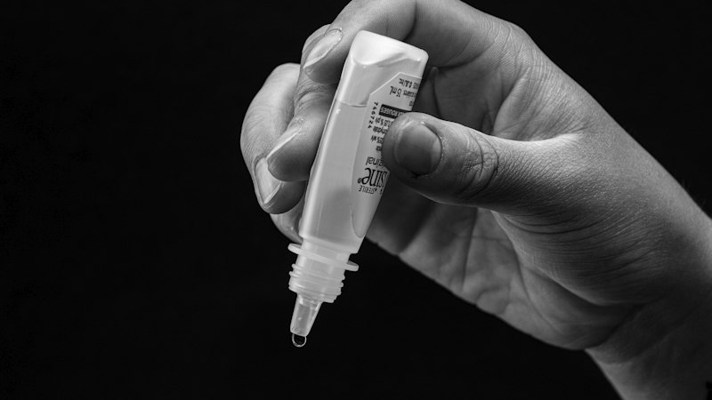 Hand holding eye drops ready to administer representing Flurbiprofen eye drop treatment